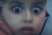 هذا ما بدا عليه وجه طفل فلسطيني قصف منزله وماتت كل عائلته (فيديو) -