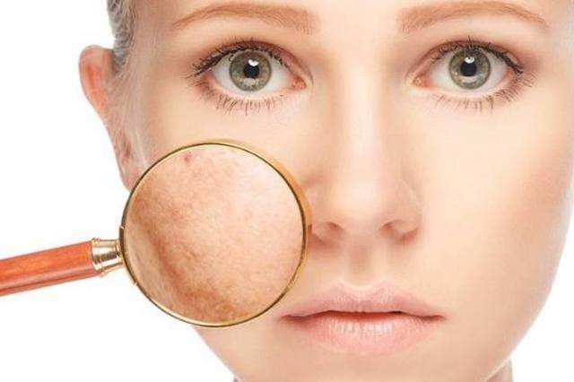 وصفات لعلاج تورم الوجه  | مجلة الجميلة