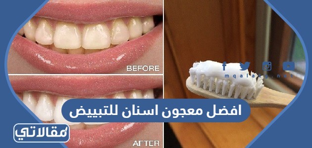 افضل معجون اسنان للتبيض والتسوس واسعارها