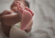 ولادة طفلة بذيل يبلغ طوله 6 سم «مغطى بالشعر والجلد» - أخبار السعودية