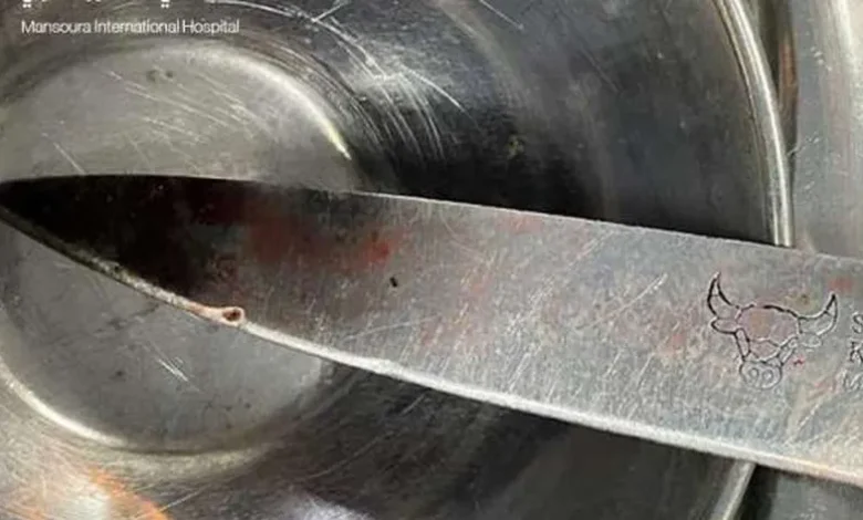 استخراج سكين مطبخ من تجويف صدر طفلة في الدقهلية
