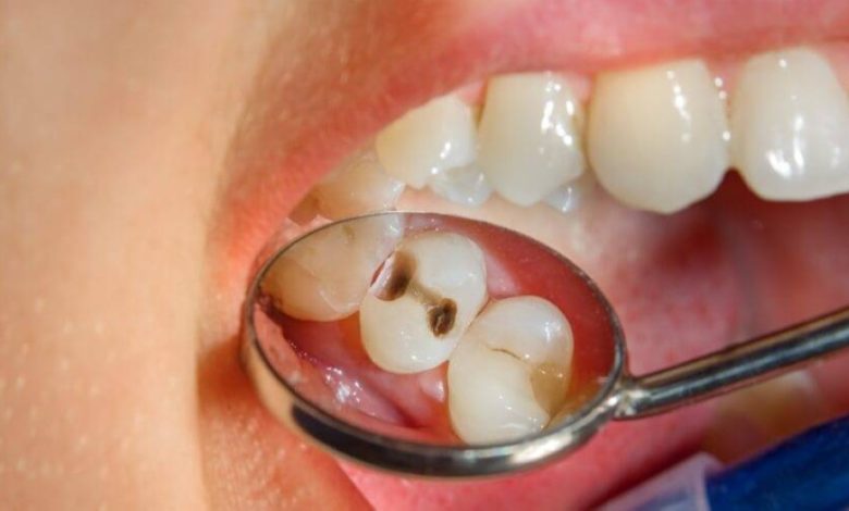 «مشوهة».. طبيب يجري 32 عملية في 5 ساعات لعلاج أسنان امرأة ! - أخبار السعودية
